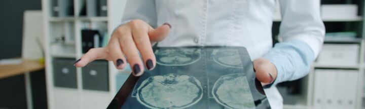 Doctor shows brain scan on tablet in office