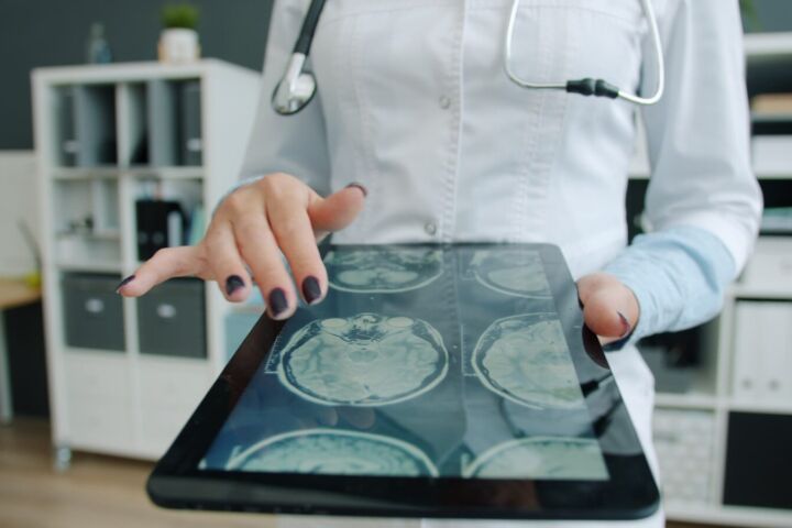 Doctor shows brain scan on tablet in office